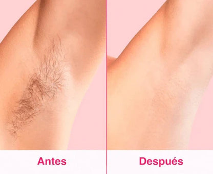 Blyss PRO® Depilador láser IPL